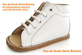 PIE PREANDANTE ADUCTO LEVE METATARSO VARO