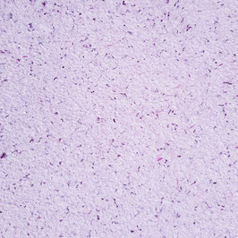 CA2 -W