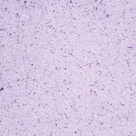 CA2 -W