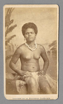 CDV : Allan Hughan, Nouméa (1834-1883) : "Indigène de la Nouvelle-Calédonie " (c. 1875)