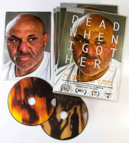 Dead when I got here  x2 DVD + 12pp booklet + free signed photos with every purchase