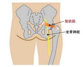 梨状筋　坐骨神経