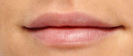 Lips Filler