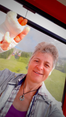 Auswirkugen Bewegungslosigkeit am Beispiel gebrochener Finger
