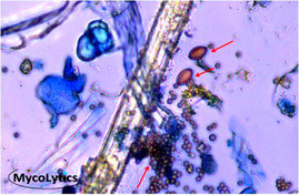MycoLytics - Partikelsammlung, Schimmelpilze, Bakterien, Holzzerstörer, Mikroskopie, Kultivierung, Staubproben, Materialproben