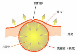 < 出典:日本形成外科学会 >