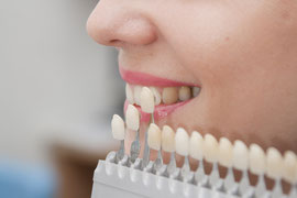 Bestimmung der Zahnfarbe vor der Aufhellung mit Hilfe einer Farb-Skala