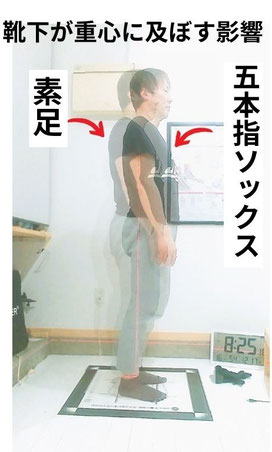 "アーチバックが発生する五本指ソックスと素足立位の比較"