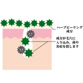 ハーブピーリング成分が毛穴に入り、菌や炎症を抑えます。アトピー肌・ニキビ肌が改善されます。