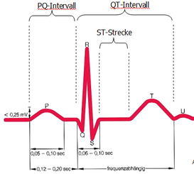 EKG-Kurve aus dem Fachbuch