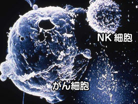 NK（ナチュラルキラー）細胞とがん細胞