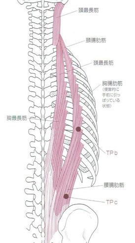 「はじめてのトリガーポイント鍼治療」より