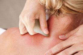 Gua Sha am Nacken