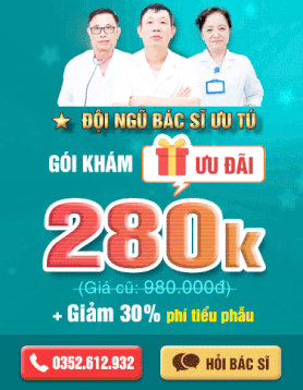Ưu đãi 280k