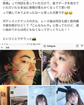 小牧 鍼治療 鍼灸 腰痛 頭痛 自律神経 美容鍼
