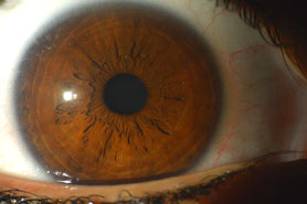 Augendiagnose Irisdiagnose - www.naturheilpraxis-binnursavas.de