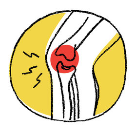 Schmerzen am Bewegungsapparat können durch Akupunktur oder Dorn-Therapie behandelt werden. Bei der Dorn-Therapie werden als erstes das Becken und die Wirbelsäule auf Fehlstellungen überprüft.