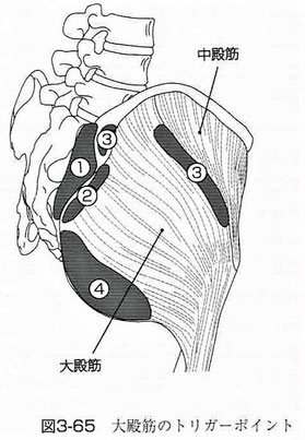 大殿筋のトリガーポイント