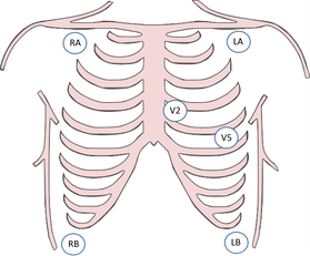 EKG-Monitor - Fokus-EKG