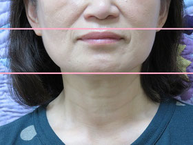 moriokachiropractic,盛岡おすすめ整体,北上おすすめ整体,岩手小顔矯正,hachimantai Chiropractic