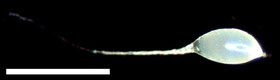 Figure 5.  A Macrodasyceras hirsutum egg.  Bar = 0.5 mm.