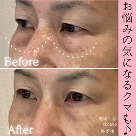 頭のむくみケア　ビフォーアフター