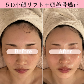 脳内洗浄　ビフォーアフター