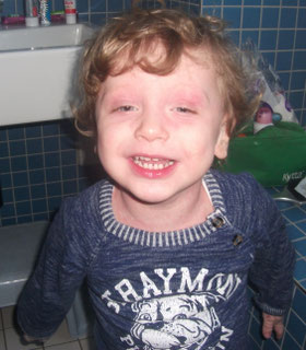 Unser älterer Sohn mit ca. 1,5 Jahren