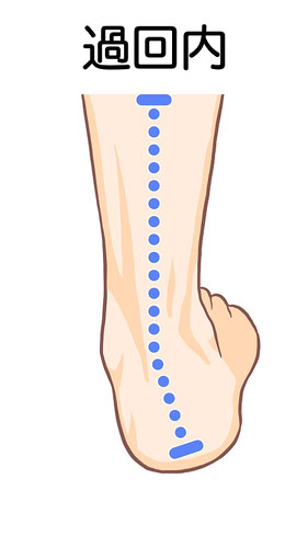 内くるぶし 下 痛い理由に答えます