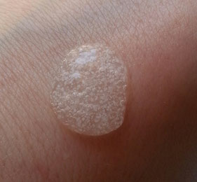 Gel