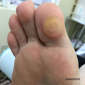オサモミ整体院 タコ