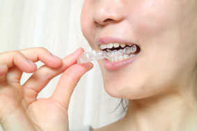 食事のたびに取り外し、歯磨きをする手間