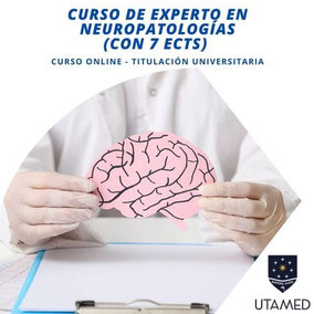 Curso de Experto en Neuropatologías (7 ECTS)