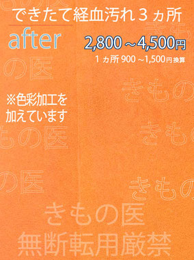 着物染み抜き料金付きクリーニングビフォーアフター画像：お尻にできた生理の経血汚れ３ヵ所の汚れの状態。しみ抜きクリーニング完了時の画像