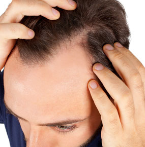 oft kommen Patienten nach einer Haartransplantation für diese Behandlung zu mir