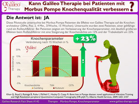 Vibrationstraining, Vibrationsplatte, Vibrationstrainer, kaufen, gebraucht, Test: www.kaiserpower.com