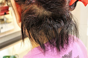 BEFORE（クリックで拡大）