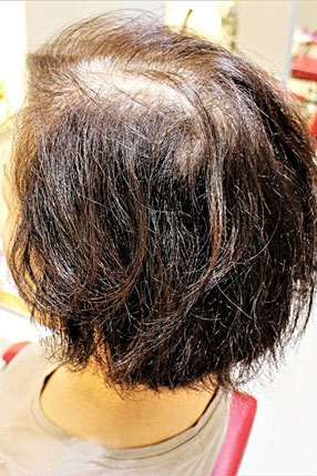 BEFORE（クリックで拡大）