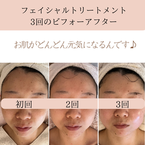 お肌が元気に　ビフォーアフター
