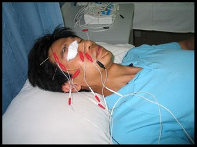 Acupunctuur behandeling bij nervus facialis parese in China (foto gemaakt door Marina van Kuilenburg)