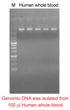 Blood / Cell genomic DNA isolation with magnetic beads 