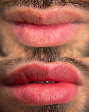 Neutralisierung männlicher Lippen - gleichmäßige frische Farbe und Fordyce Drüsen kaschiert