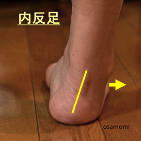 内反足、踵の異常、Ｏ脚、足首痛、昭島市のオサモミ整体院