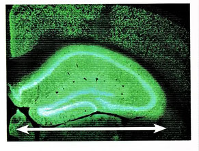 通常のマウスの海馬