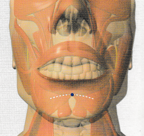 Sur la ligne médiane du visage, au centre du sillon mento-labial