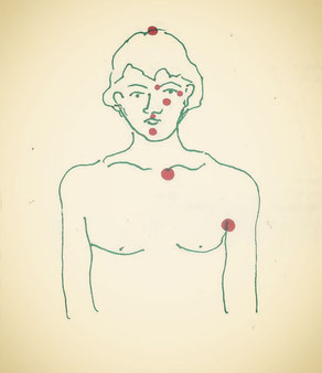 Punkte der Klopftherapie
