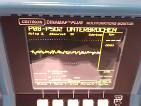 Dinamap Plus Multifunktions Monitor für Medizin und Praxis