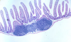 lipoxygenase阻害剤およびα-glucosidase阻害剤の分離・精製