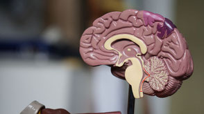 Ergotherapie Rheinfelden – Modell des Gehirns für neurologische Rehabilitation und kognitives Training