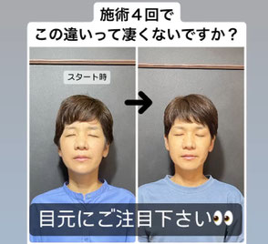 目元の変化に注目！